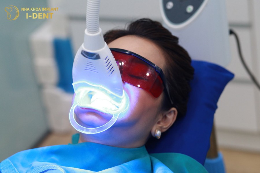 Tay-trang-rang-cong-nghe-Plasma