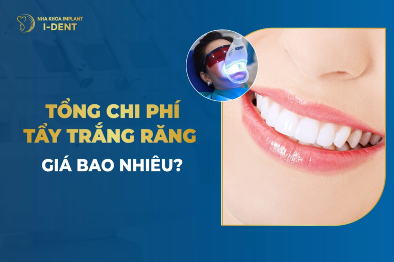 Tẩy trắng răng giá bao nhiêu? Bảng giá 2026