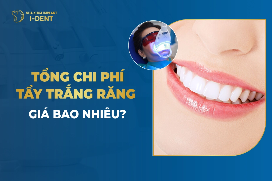 Tẩy trắng răng giá bao nhiêu? Bảng giá 2026