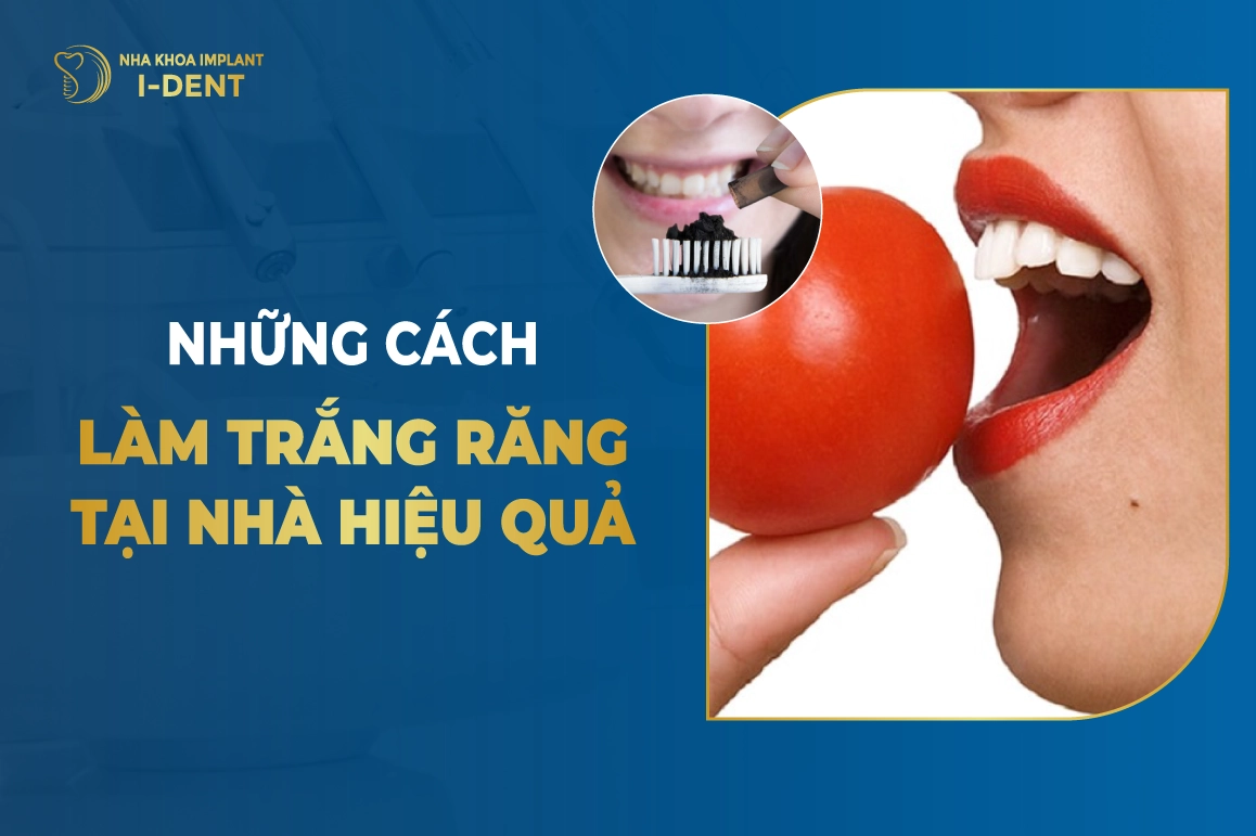 Những Cách Làm Trắng Răng Tại Nhà Hiệu Quả