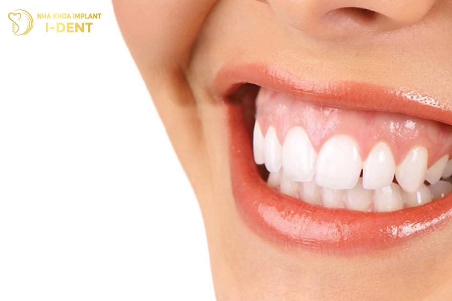 Nu-cuoi-tro-nen-kem-duyen-do-nhung-chiec-rang-cua-bi-tut-loi