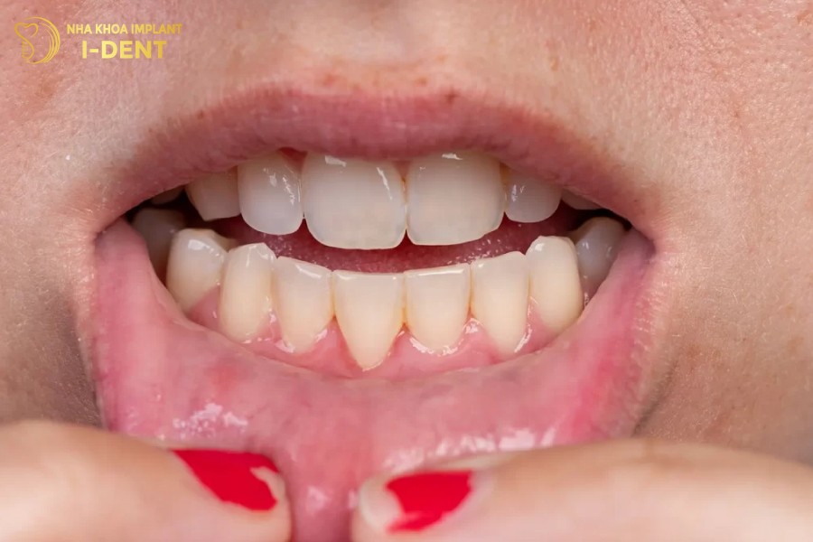 Phan-loi-bi-ton-thuong-khong-the-tu-phuc-hoi-duoc