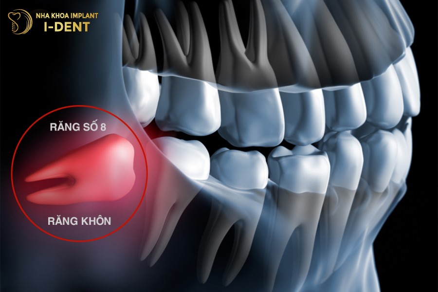 Rang-khon-la-rang-so-8-nam-o-phia-trong-cung-cua-ham-rang