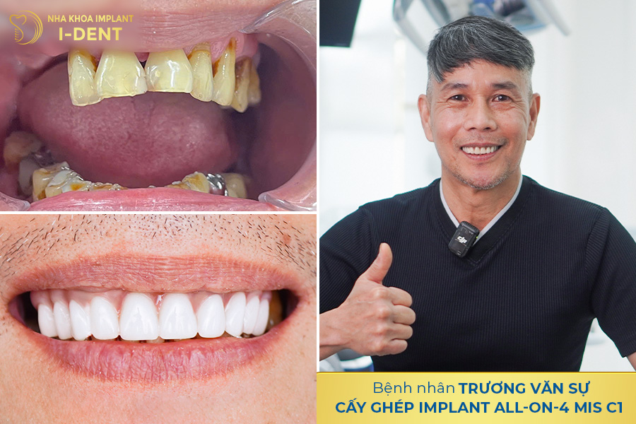 Hình ảnh trước và sau khi điều trị của chú Văn Sự