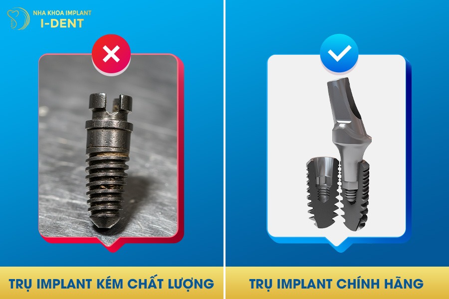 trồng răng implant có hôi miệng hay không