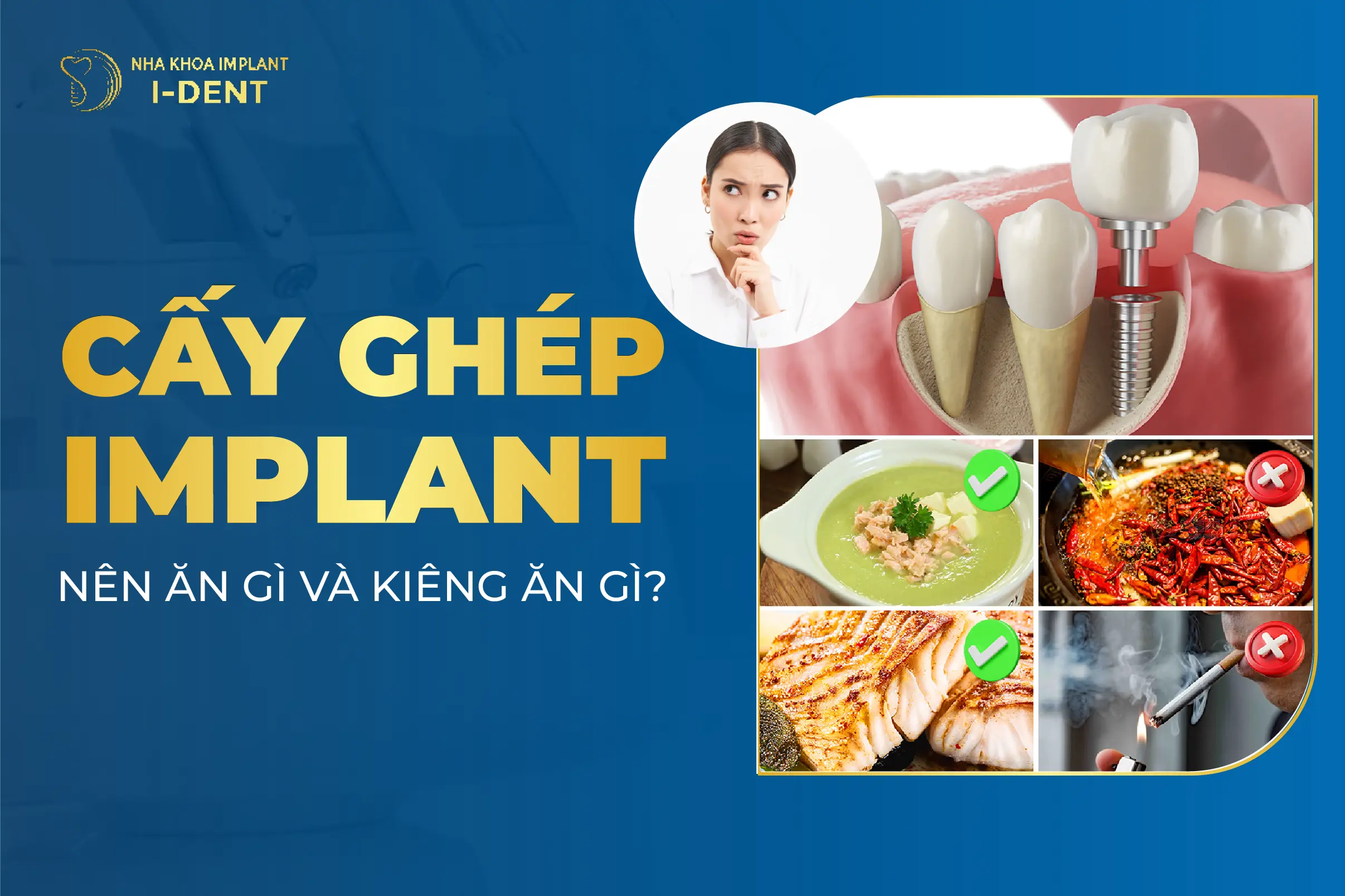 Cấy Ghép Implant Nên Ăn Gì Và Kiêng Ăn Gì?