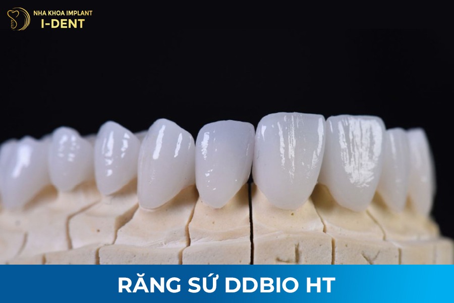 bọc răng toàn sứ