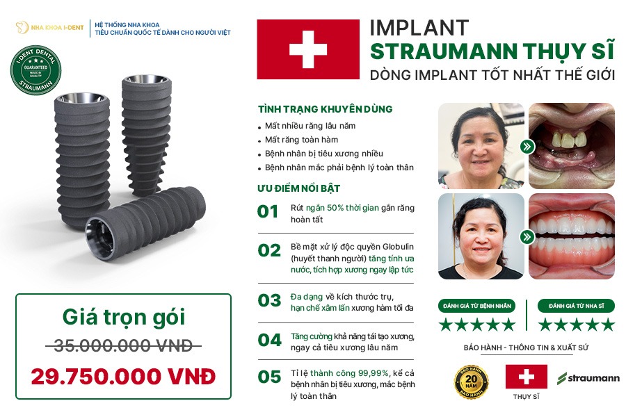 các loại trụ implant