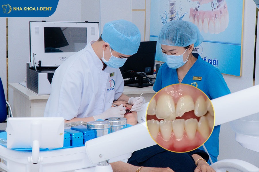 gãy răng cửa phải làm sao