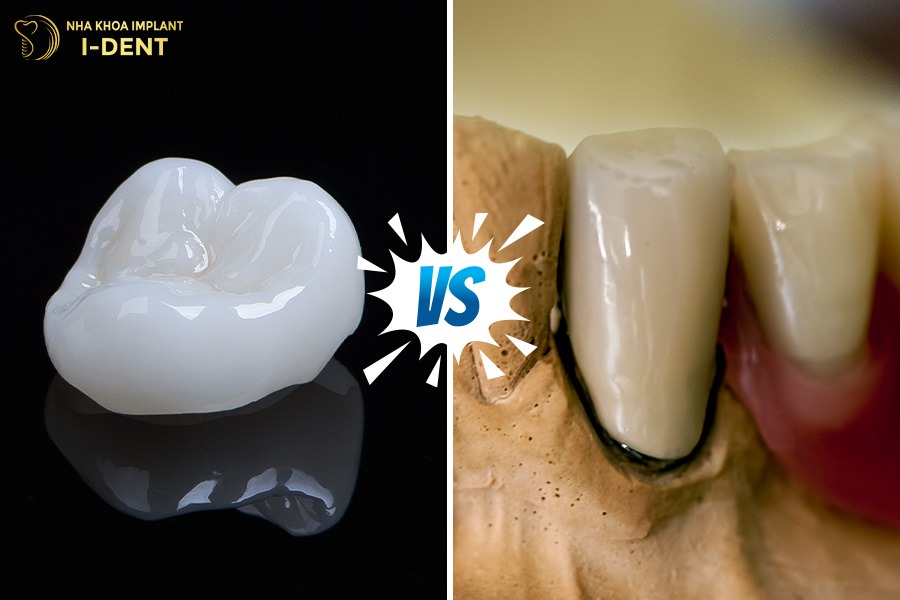 răng sứ cao cấp