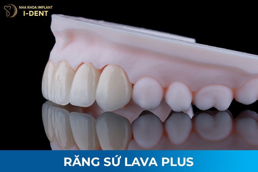 răng sứ toàn phần