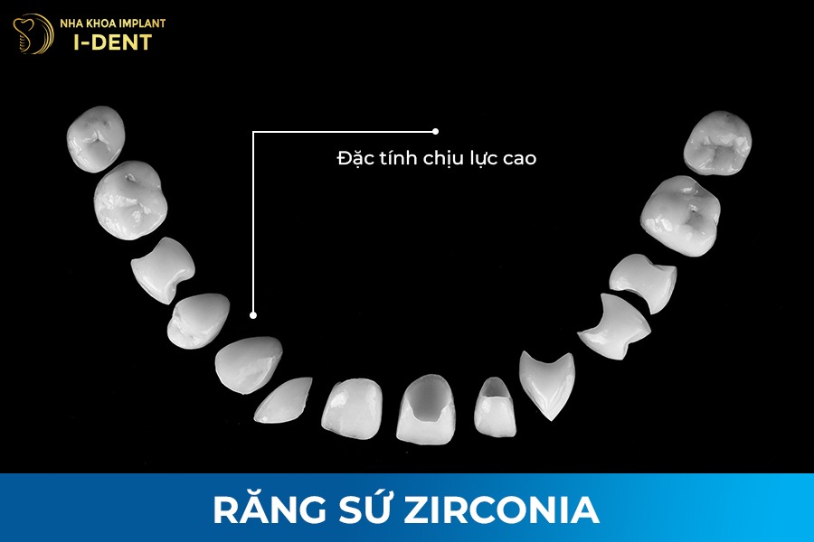 răng toàn sứ có mấy loại