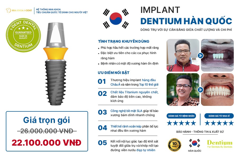 trồng răng implant loại nào tốt