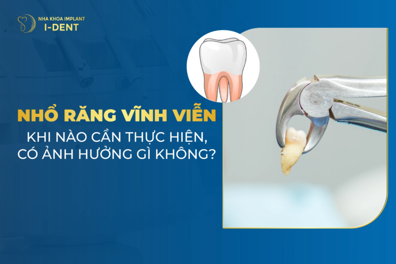 Nhổ răng vĩnh viễn có ảnh hưởng gì không? Quy trình nhổ?