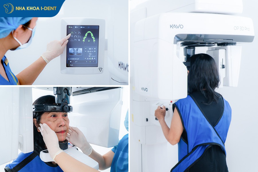 cấy ghép implant mất bao lâu