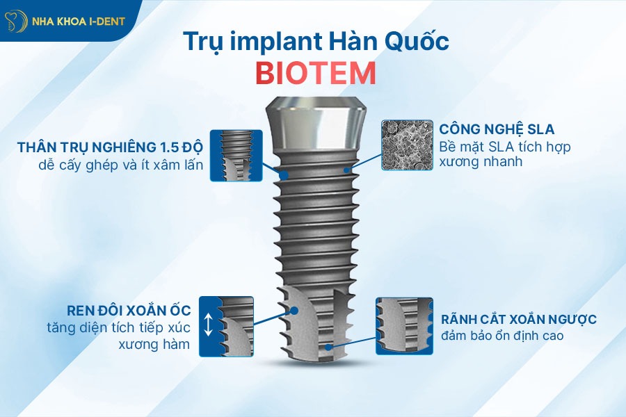 giá trụ implant hàn quốc