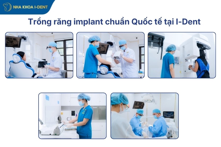 hối hận vì trồng răng implant