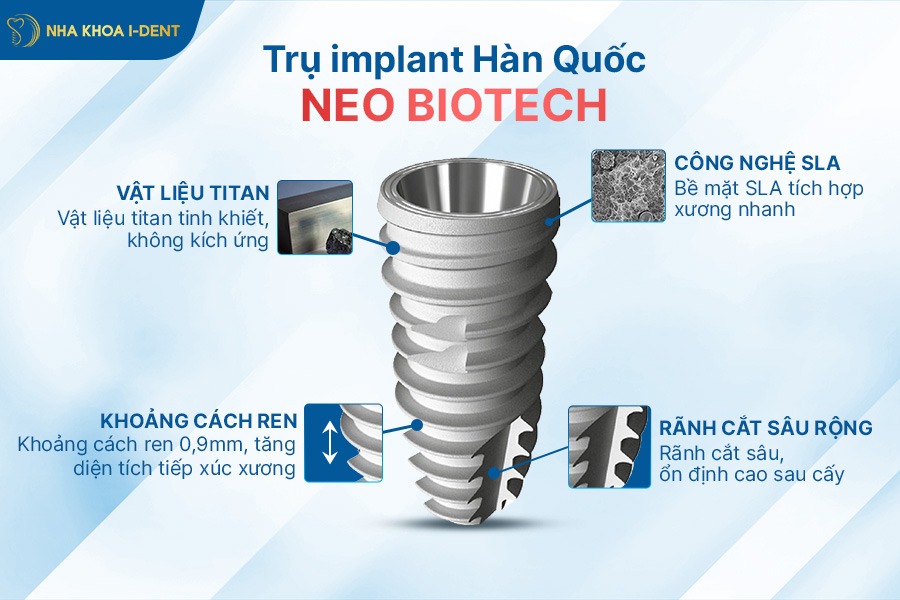 implant hàn quốc có mấy loại