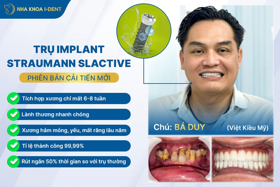 implant thụy sĩ