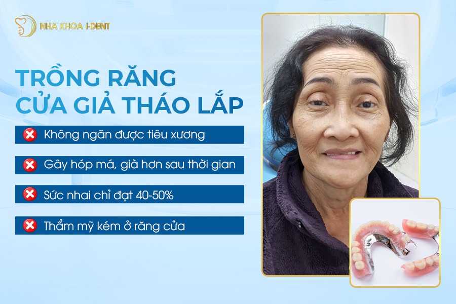 trồng răng cửa