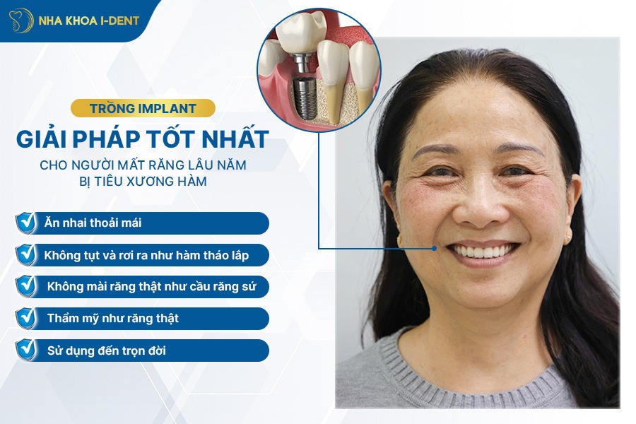 mất răng lâu năm có trồng lại được không