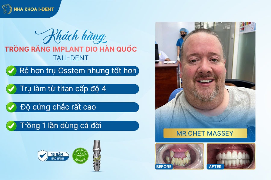 Trụ implant osstem hàn quốc