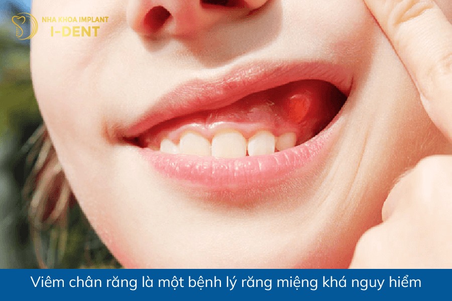 chan rang co chuc nang gi