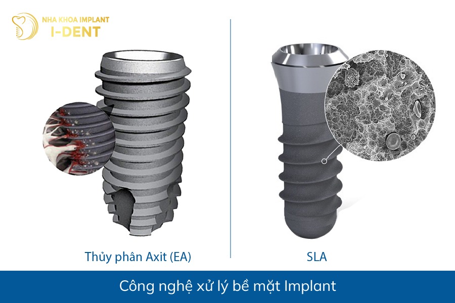 so sánh các loại trụ implant