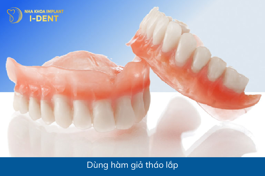 mất răng ở hàm dưới