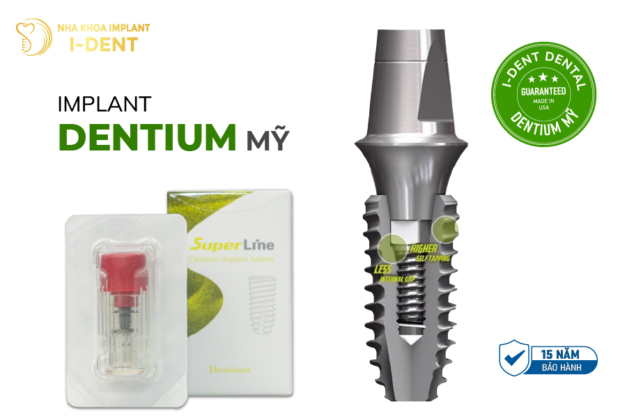 implant loại nào tốt