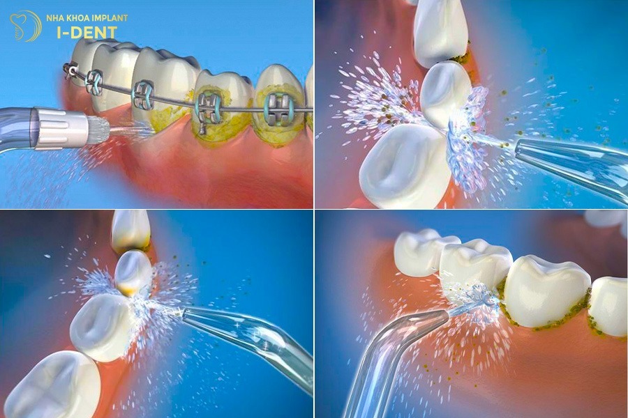 Cách sử dụng tăm nước