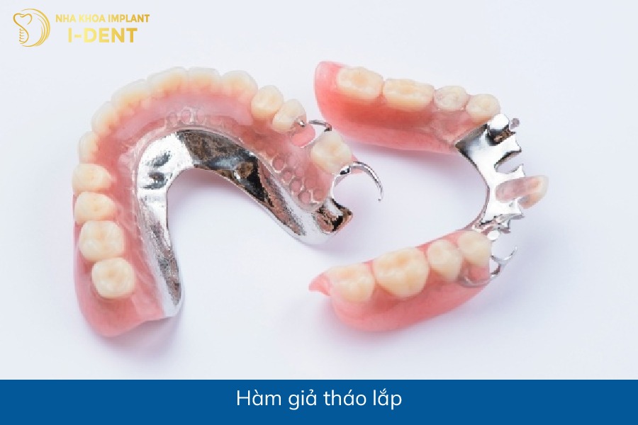 bị mất răng thì phải làm sao