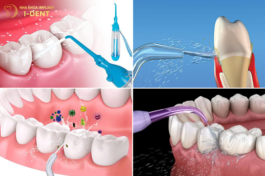 có nên dùng tăm nước