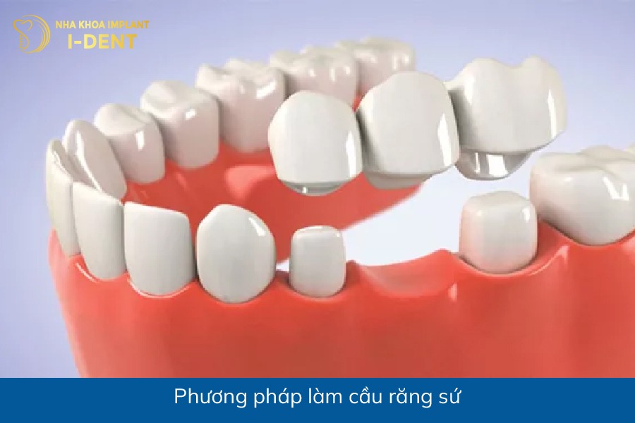 mất răng nên làm gì