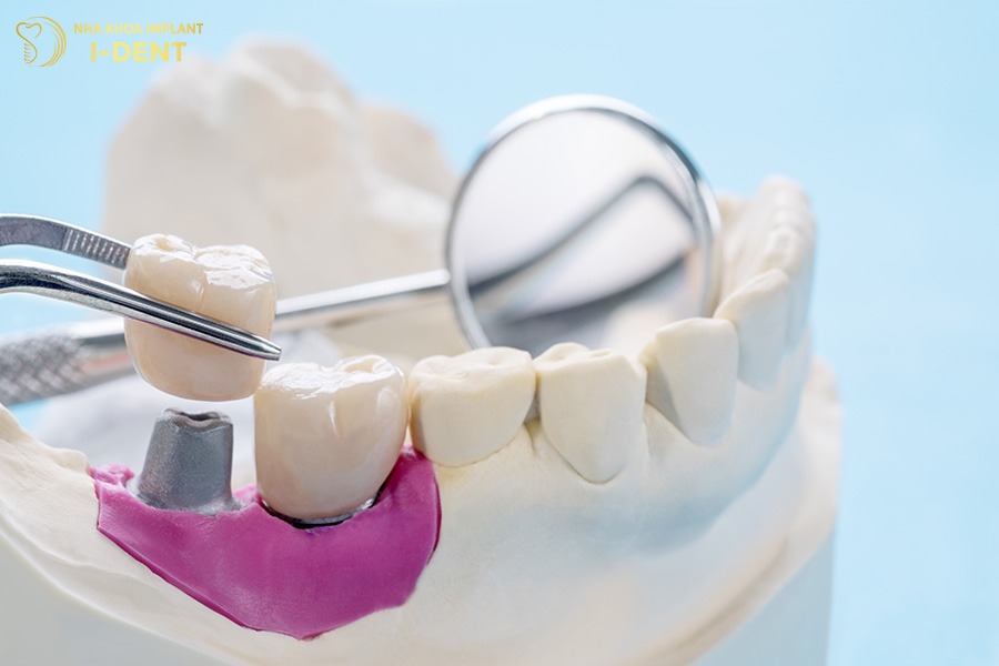 không trồng răng có sao không