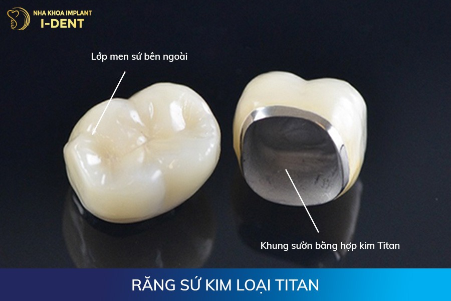 răng sứ có mấy loại