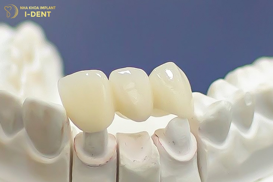 trồng răng bị sâu