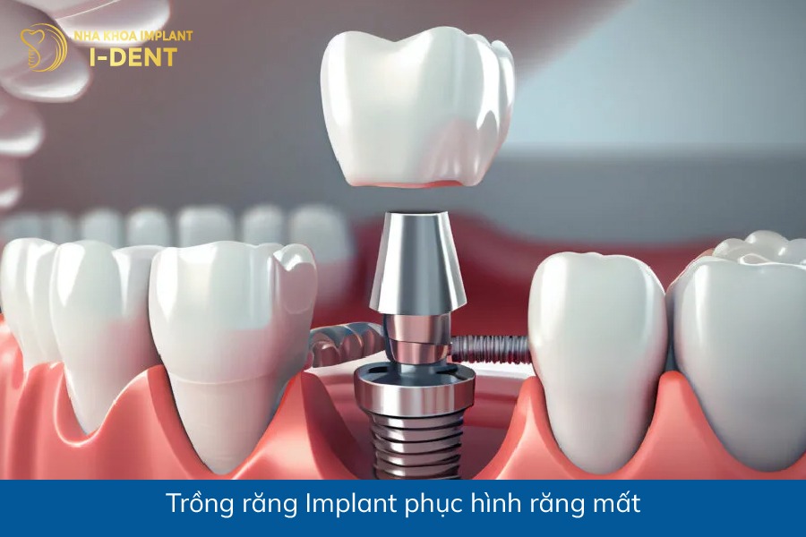 mất răng thì phải làm sao