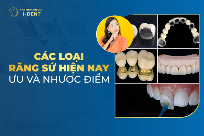 Các Loại Răng Sứ Hiện Có Mấy Loại? Ưu Và Nhược Điểm?