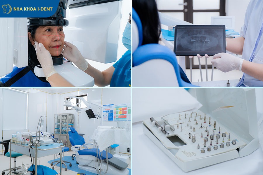 giá trồng răng sứ vĩnh viễn