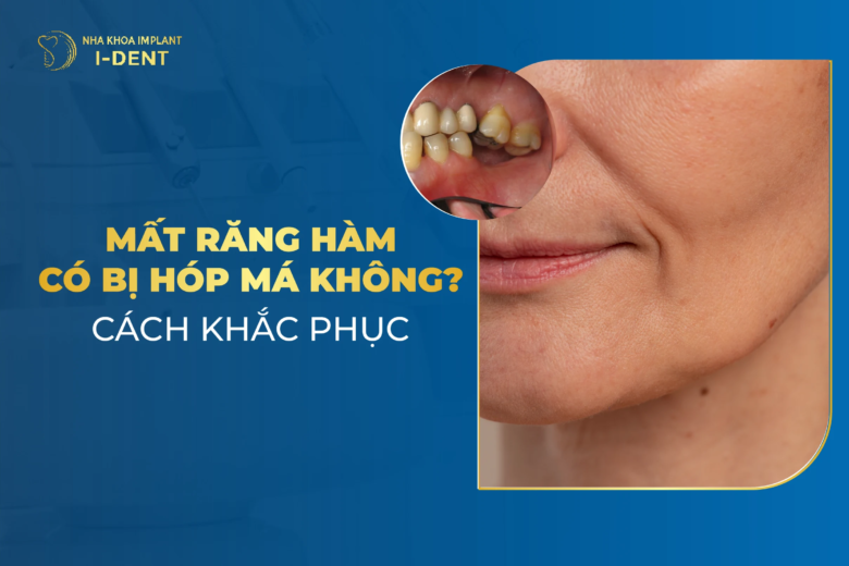 Mất răng hàm có bị hóp má không? Cách khắc phục hiệu quả