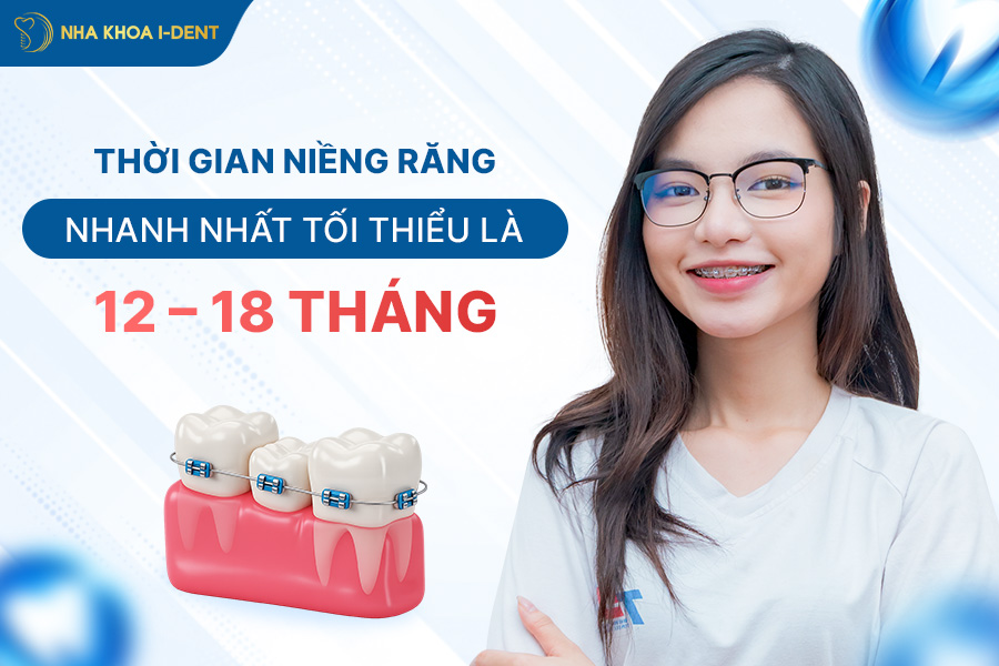 Giai đoạn dậy thì có thời gian niềng răng nhanh nhất là khoảng từ 12 - 18 tháng