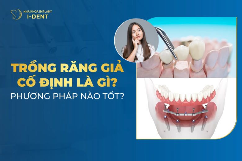 Trồng răng giả cố định có ưu nhược điểm gì?