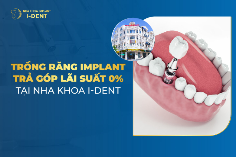 Trồng răng implant trả góp 0% lãi suất tại nha khoa uy tín