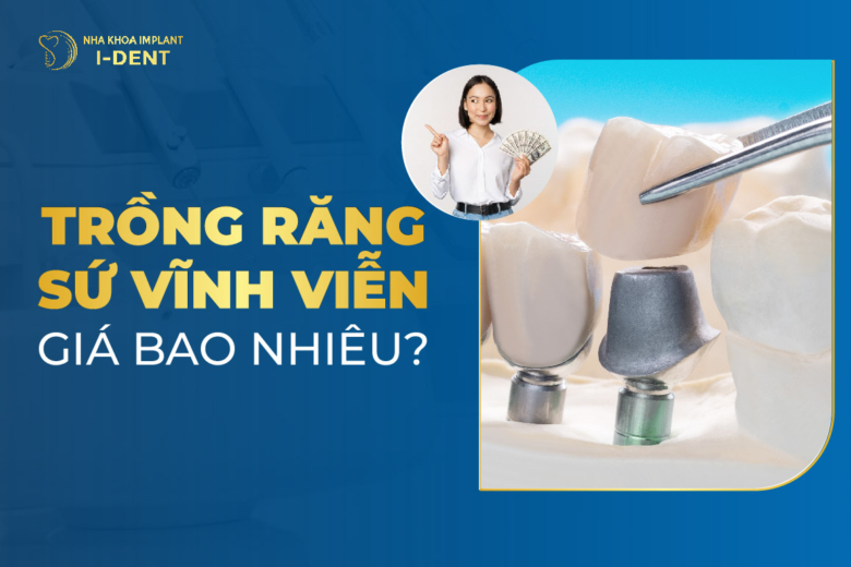 Trồng răng sứ vĩnh viễn giá bao nhiêu? Chọn trồng loại nào? Quy trình