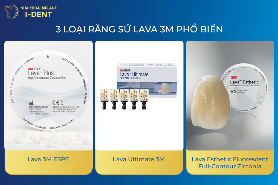 răng sứ Lava Plus 3M ESPE