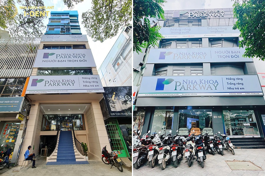 bọc răng sứ ở đâu tốt nhất