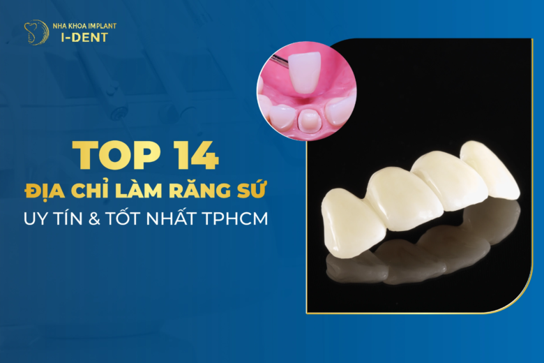 Top 14 Địa Chỉ Làm Răng Sứ Uy Tín Nhất TPHCM