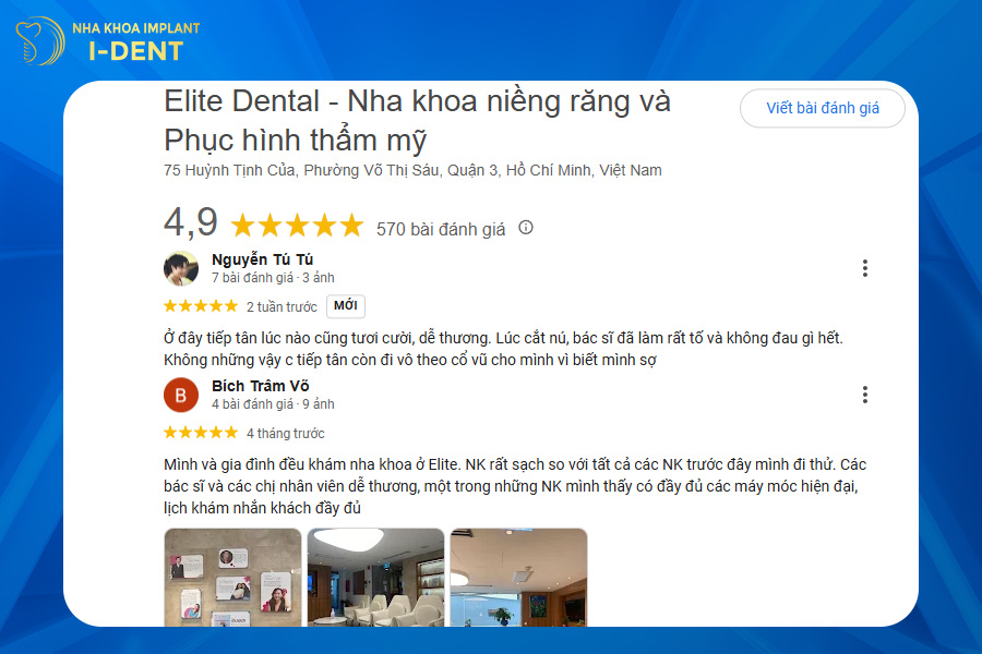 cơ sở niềng răng uy tín tại tphcm