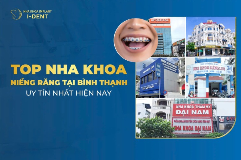 Top 5 nha khoa niềng răng tại Bình Thạnh uy tín nhất hiện nay